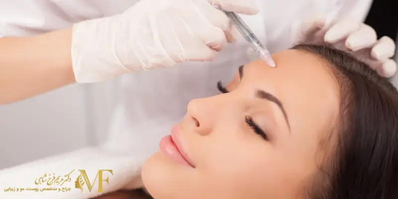 تزریق بوتاکس پیشانی روشی برای از بین بردن چین و چروک