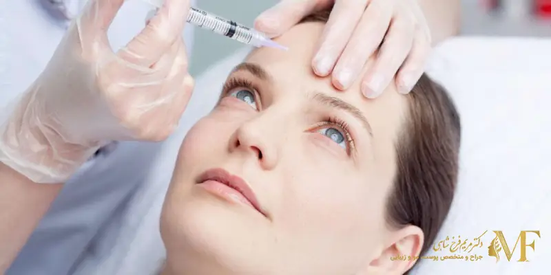 مراحل تزریق بوتاکس پیشانی