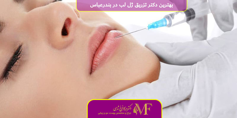 بهترین دکتر تزریق ژل لب در بندرعباس