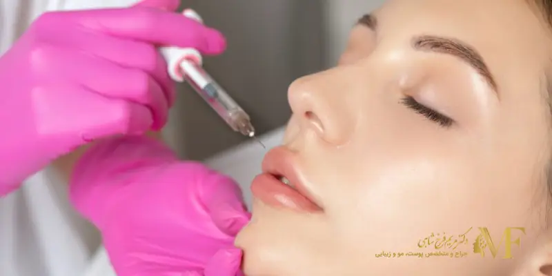 تزریق بوتاکس لب و کاربردهای آن