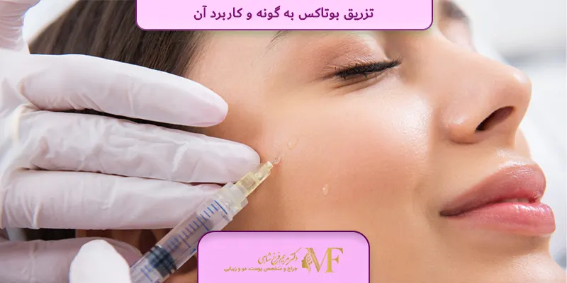 تزریق بوتاکس به گونه و کاربرد آن