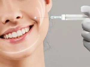 تزریق بوتاکس خط خنده