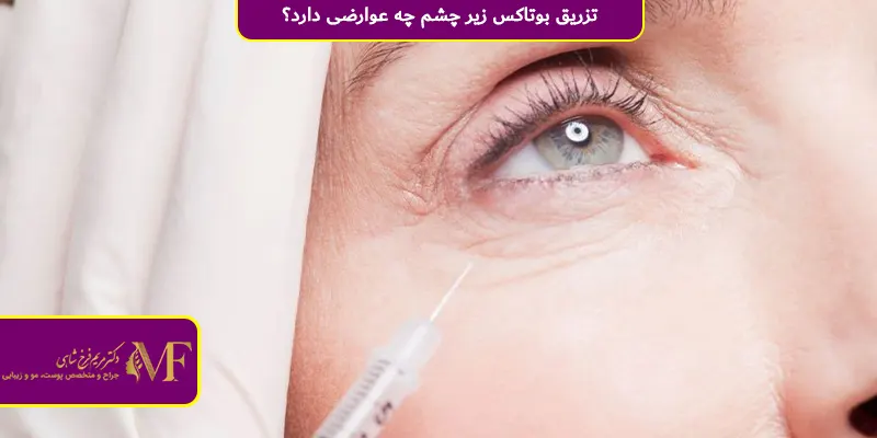 تزریق بوتاکس زیر چشم چه عوارضی دارد؟