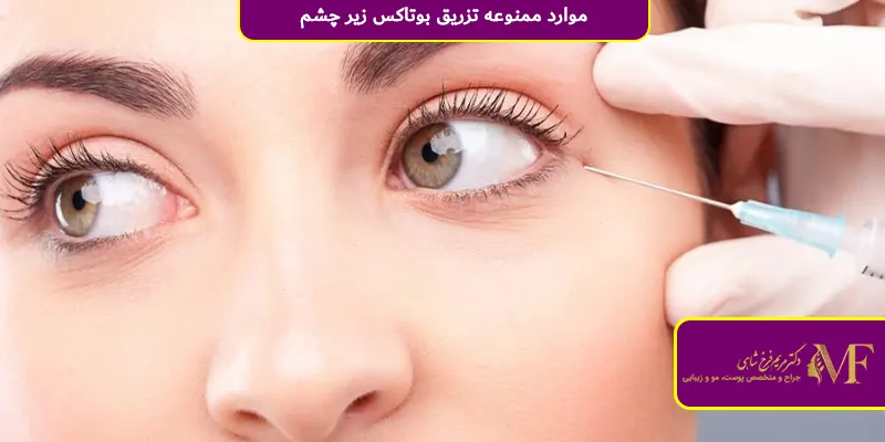 موارد ممنوعه تزریق بوتاکس زیر چشم