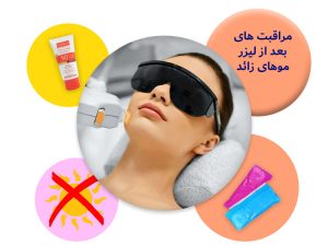 مراقبت های بعد از لیزر موهای زائد