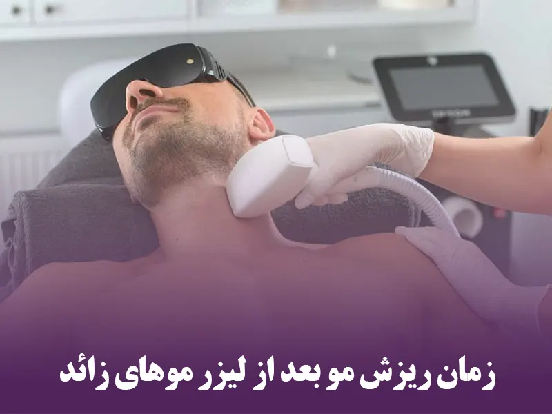 زمان ریزش مو بعد از لیزر موهای زائد