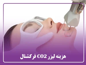 هزینه لیزر CO2 فرکشنال