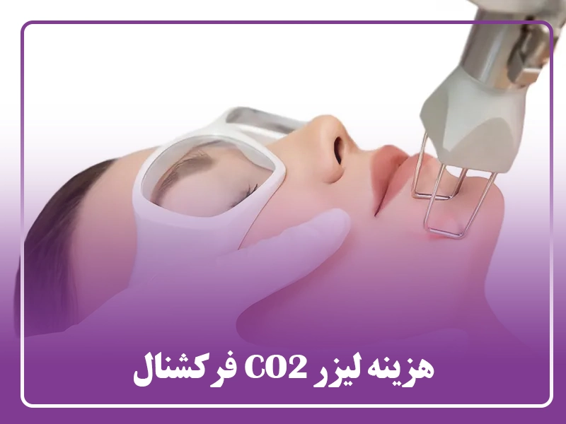 هزینه لیزر CO2 فرکشنال
